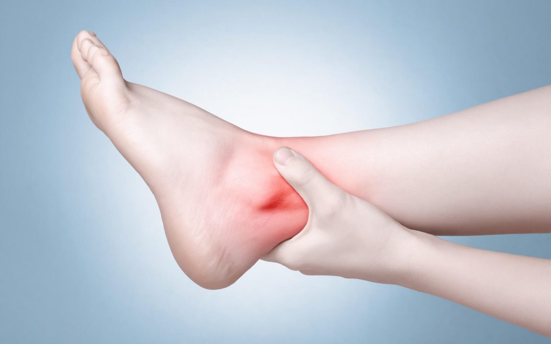 How Long Does A Sprained Ankle Take To Heal?